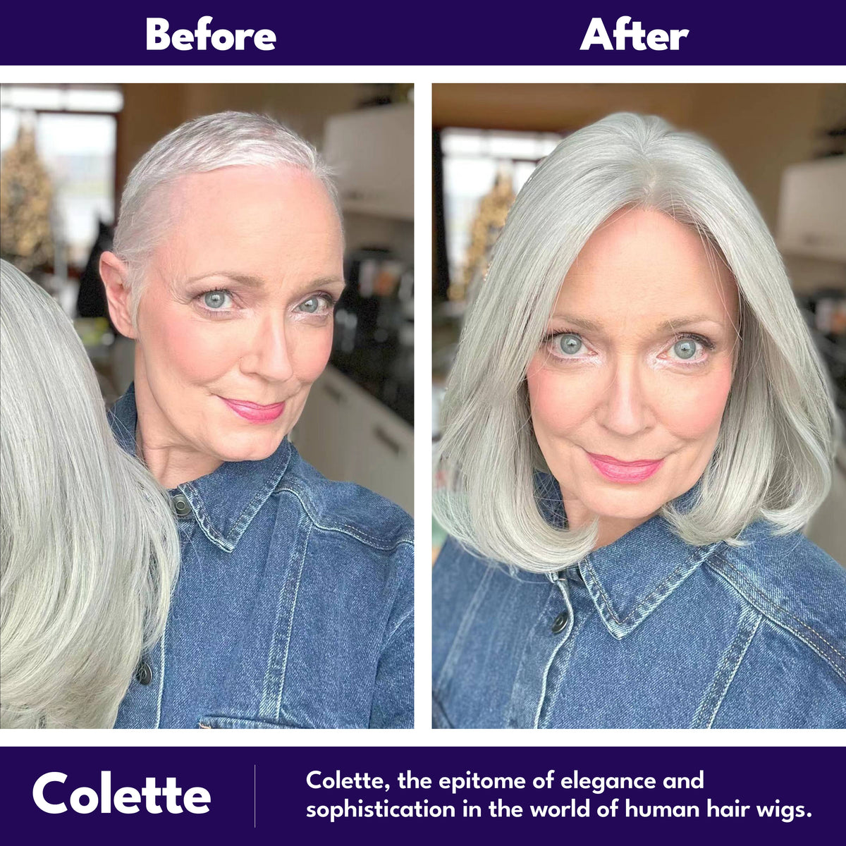 Colette wig before after transformation chemotherapy hair loss medical support